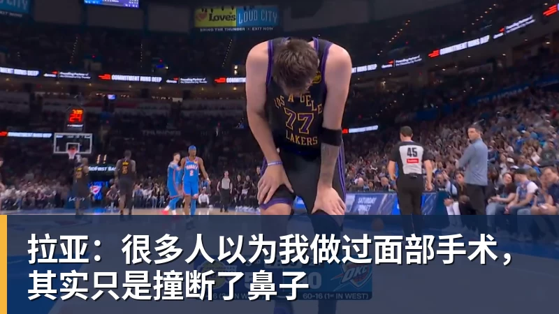 拉亚:很多人以为我做过面部手术,其实只是撞断了鼻子